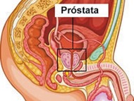 Thumb_prostata